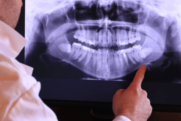 Best Emergency Dental Services for Seniors in Ashford, AL